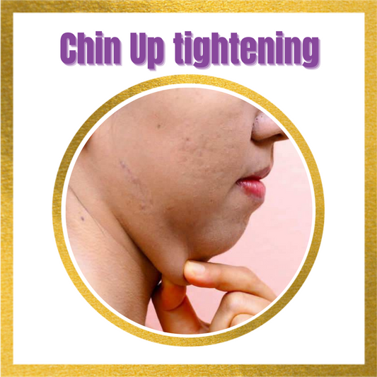 Chin Up Tightening