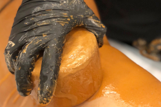 Ice Body Sculpting