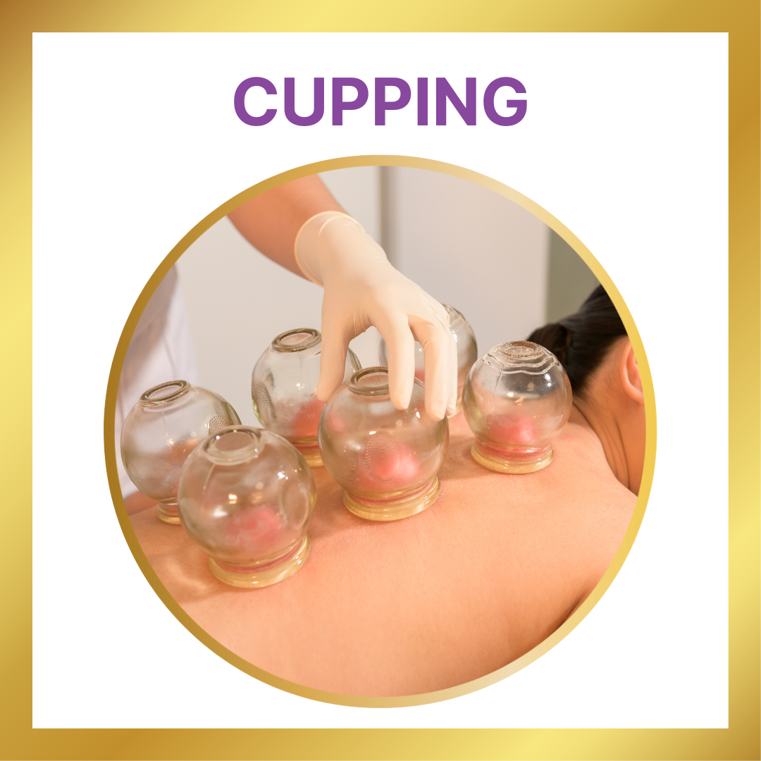 Cupping