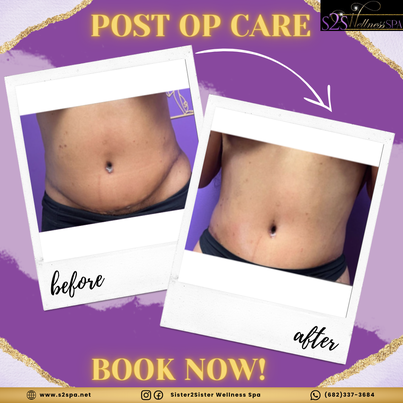 Post op Lymphatic Care
