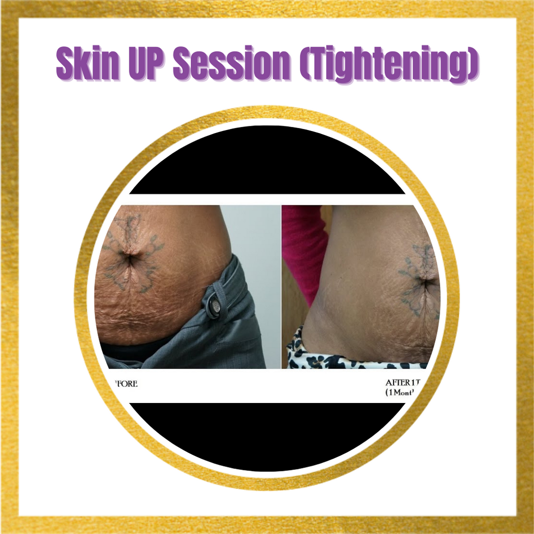 Tight and tone  (Tightening)