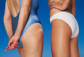 Bye Cellulite Be Gone